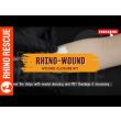 Rhino Rescue Wound Closure Kit: Stitchless & Pain-Free Solution for Cut Wounds thumbnail